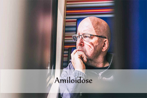 Amiloidose: causas, sintomas, diagnóstico e tratamento