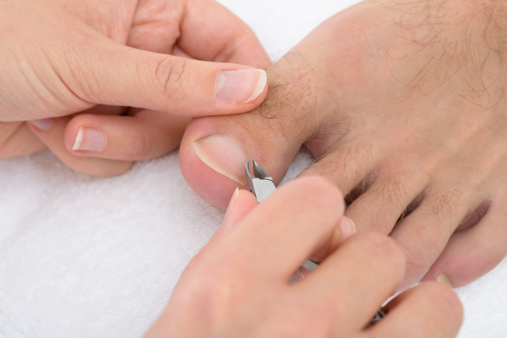 Como suavizar as unhas dos pés para cortar ou recortar em casa